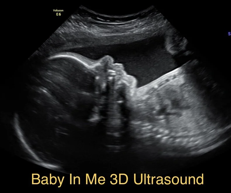 3d ultrasound with heartbeat top teddy bear near me